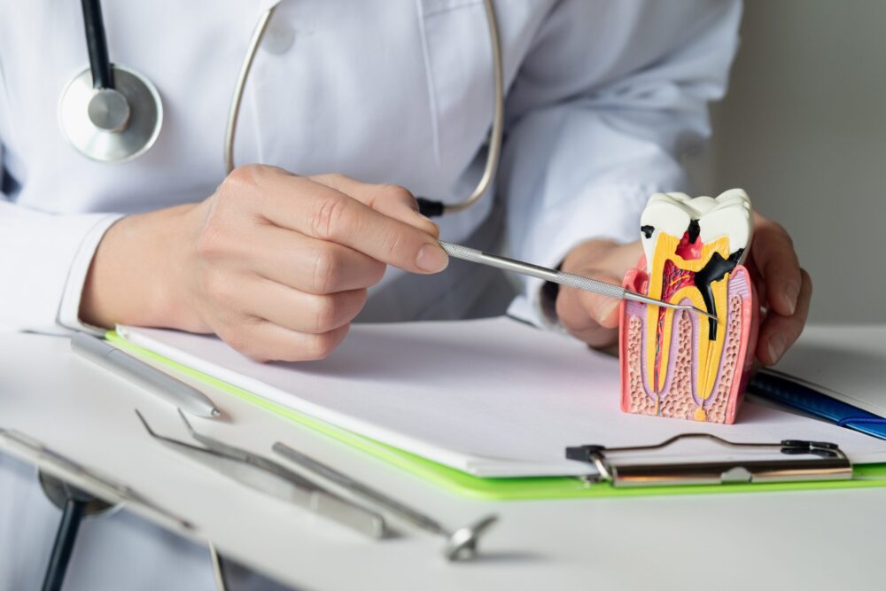 Root Canal Therapy Littleton