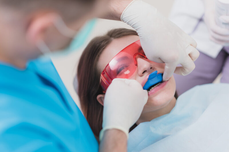 Fluoride Treatment Littleton